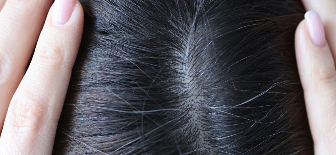 closeup-gray-hair-woman-head-trichology-hair-treatment-concept
